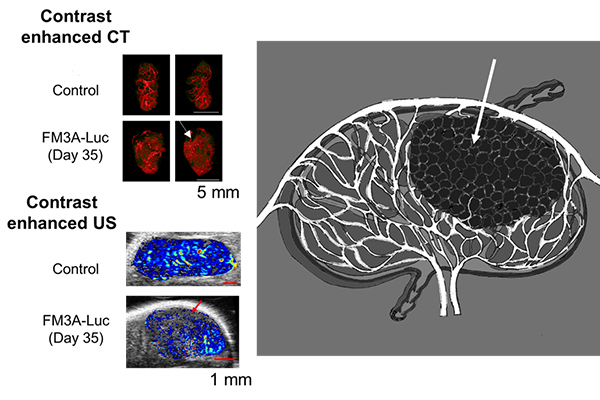 20211101_pr_kodama_lymph_node_pic1.jpg