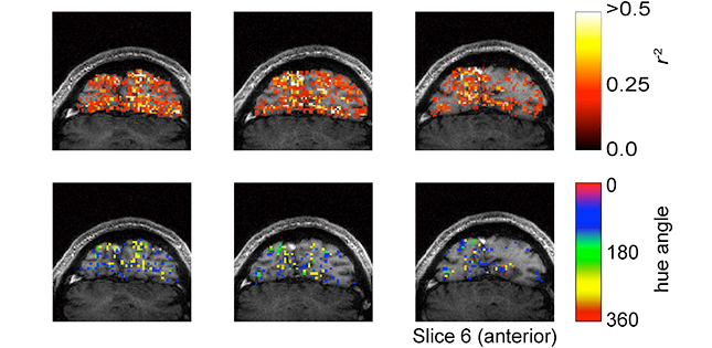 Human visual cortex holds neurons that selectively respond to intermediate colors