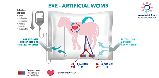 Artificial womb raises hope for premature babies