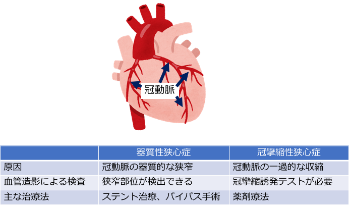 良性筋線維束性攣縮症