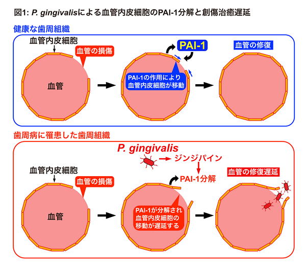 歯周病菌が血管の修復を妨げる仕組みを発見 歯周病 プレスリリース 研究成果 東北大学 Tohoku University