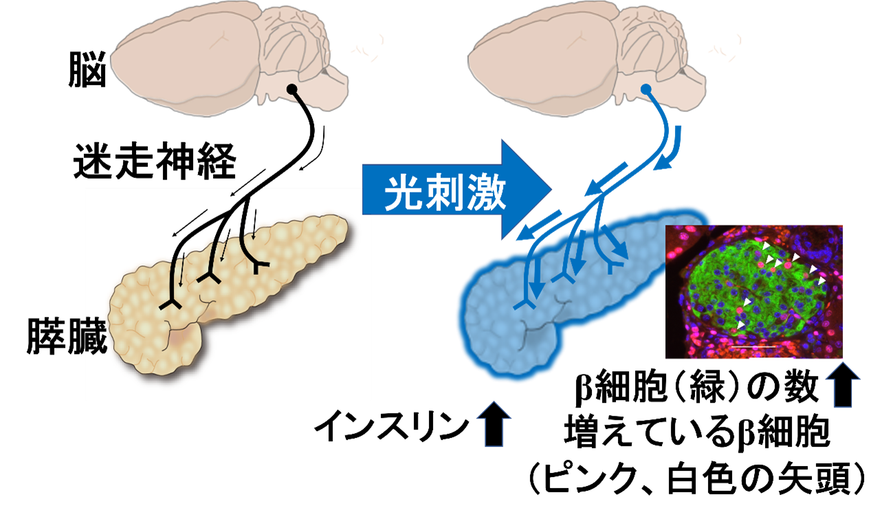 アフレッツァの代替品