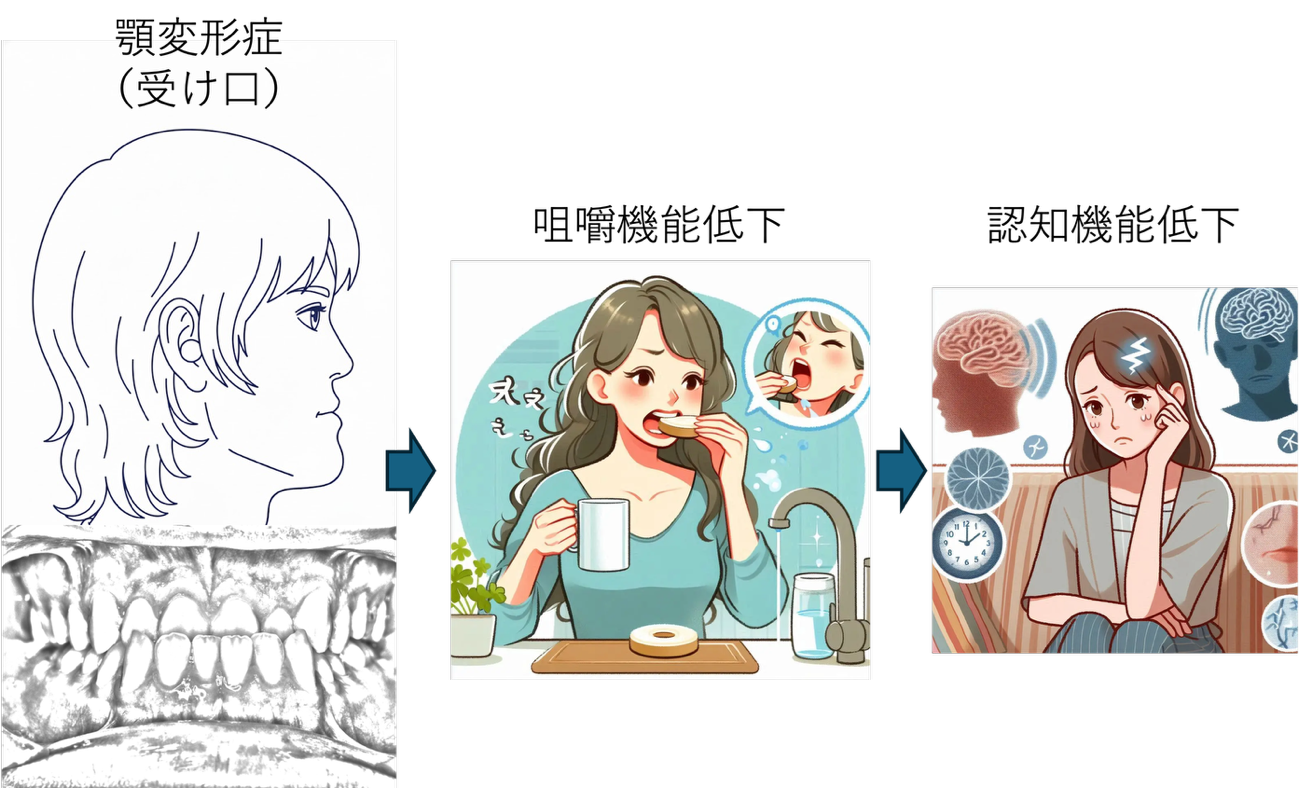 「受け口」患者の咀嚼時脳血流と認知機能の関連を解析～患者群内で相関関連が認められることを確認～