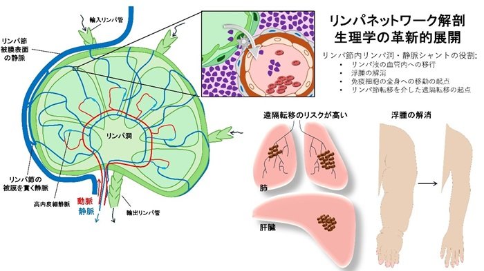 がん転移とリンパ浮腫の根治につながる新発見～リンパ節内のリンパ洞・静脈シャント特定がもたらす 薬物動態設計のパラダイムシフト～