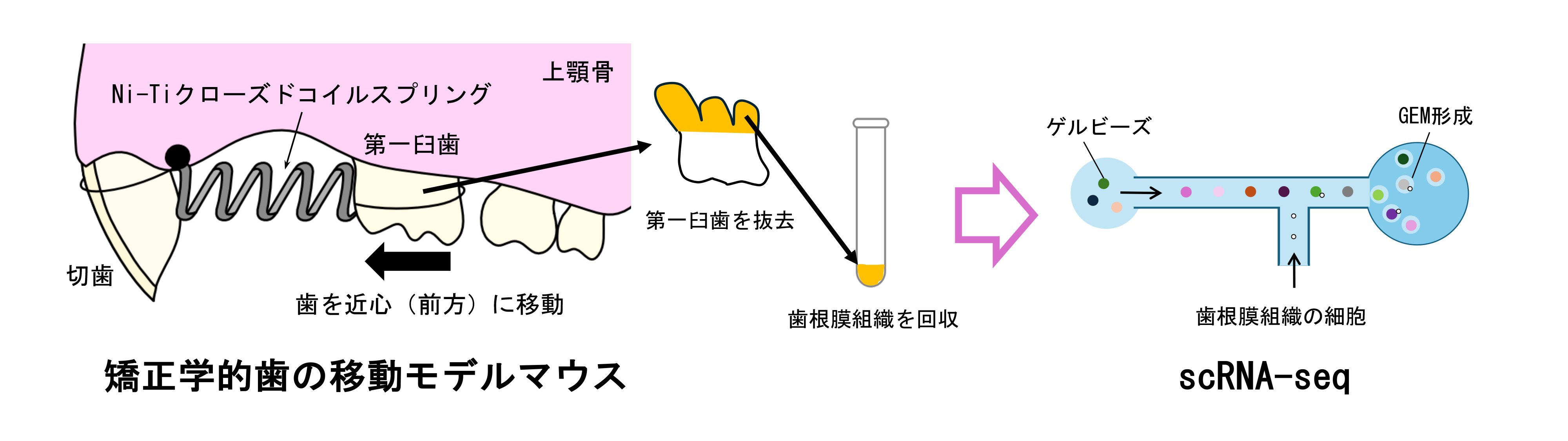 免疫細胞「好中球」が歯の移動をコントロール ―効率的で安全な矯正歯科治療の実現へ―