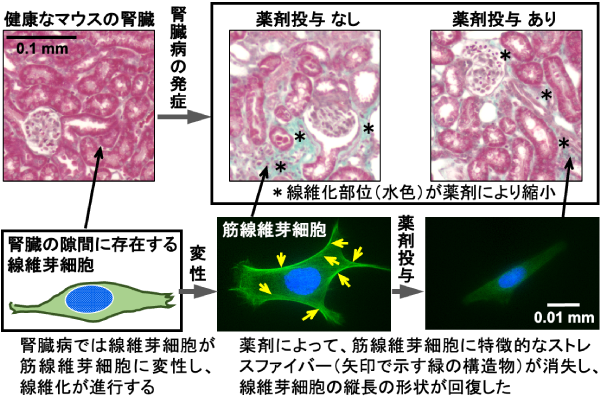 腎臓病により変性した細胞の修復をマウスの実験で確認 ―腎臓病の治療戦略に新たな道筋―