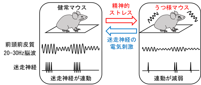 迷走神経は情動を形成するための脳活動と連動する～治療抵抗性のうつ病などに対する新規治療法開発への貢献に期待～