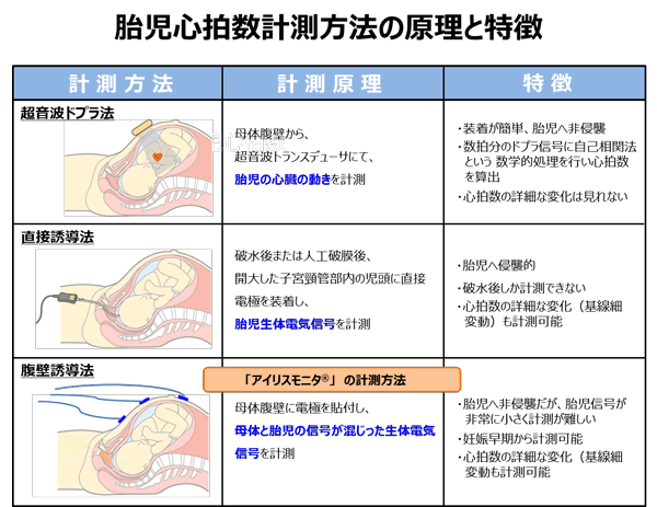 赤ちゃん　心拍モニター